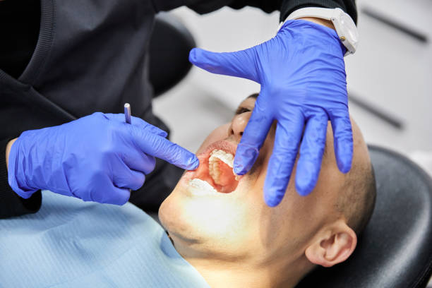 Best Knocked-Out Tooth (Avulsed Tooth) Treatment in Mount Sterling, KY