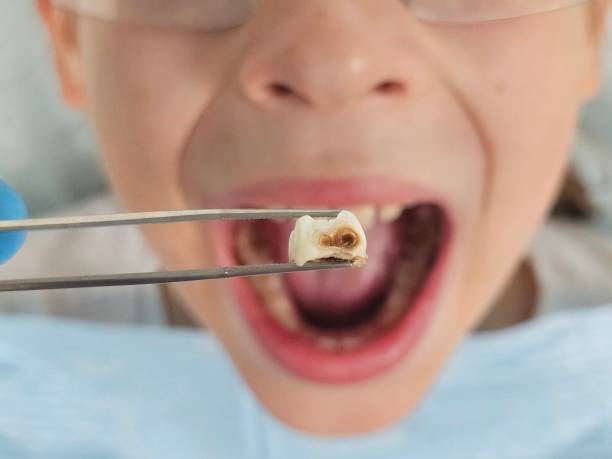Best Emergency Denture Repair in Mount Sterling, KY